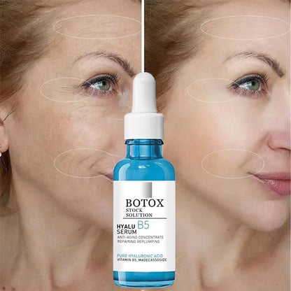 SkinLift™ Anti-Aging Serum